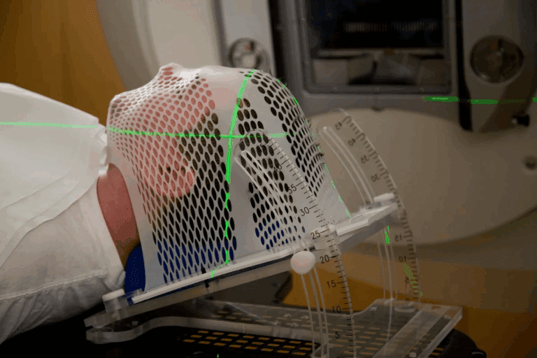 What Are The Pain From Radiation Side Effects?5 Alarming Effects