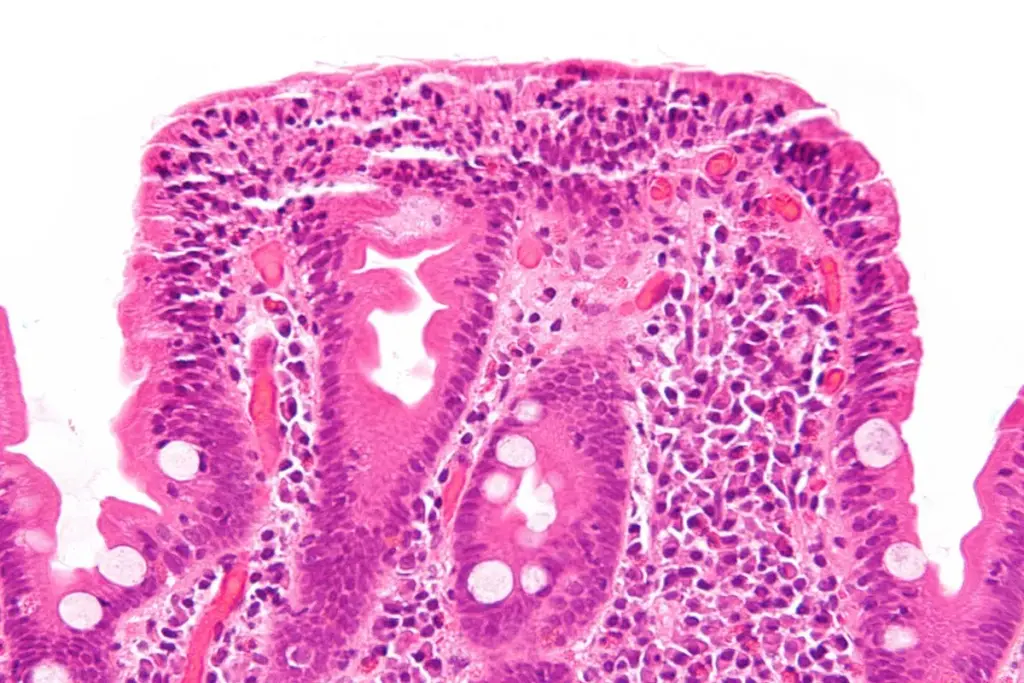 How to Read a Celiac Diagram: A Step-by-Step Guide