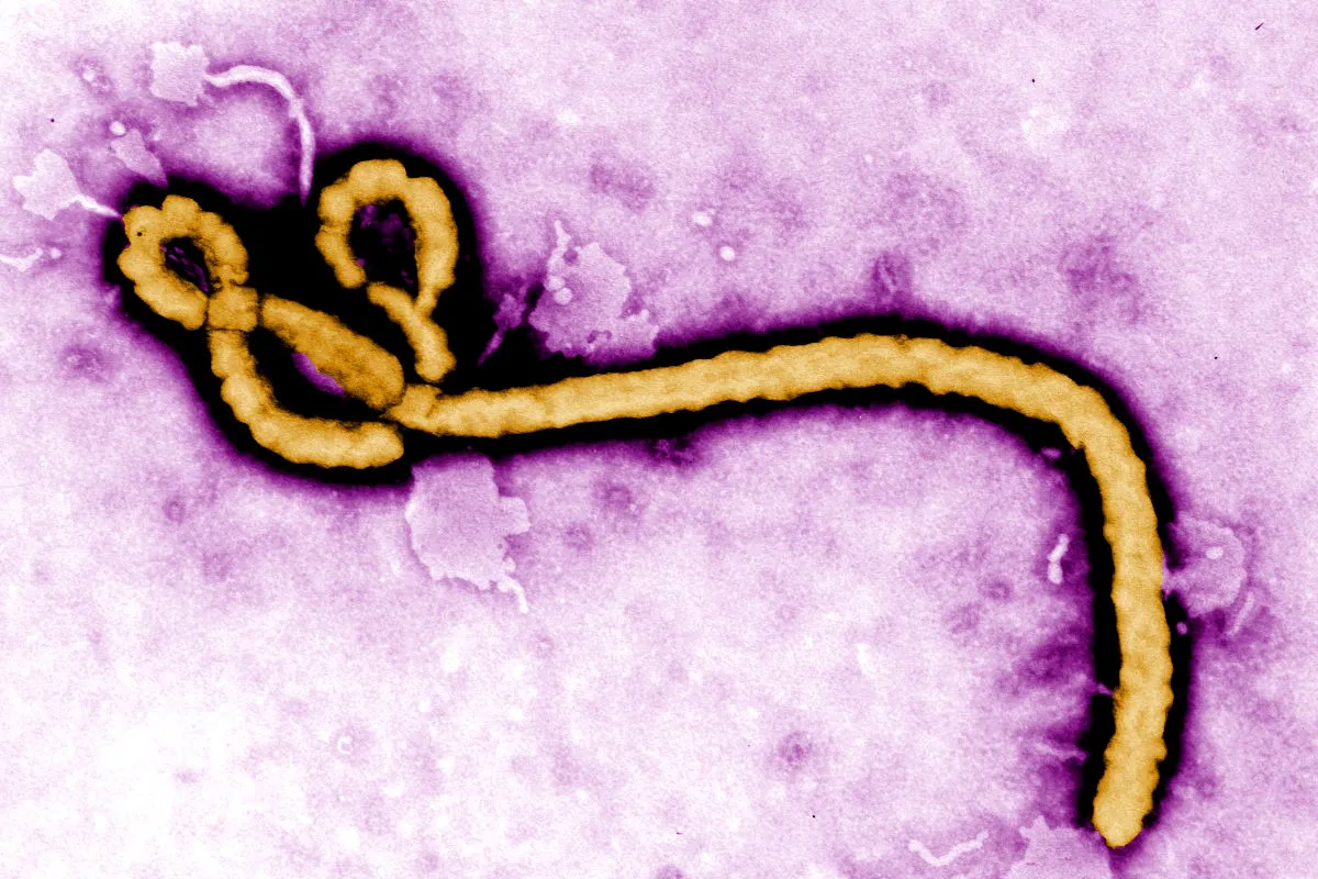 Ebola Virus Disease