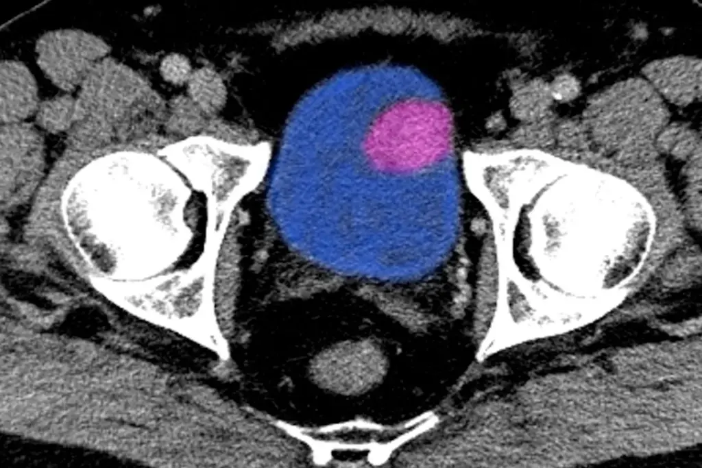 Modifiable and Environmental Risk Factors