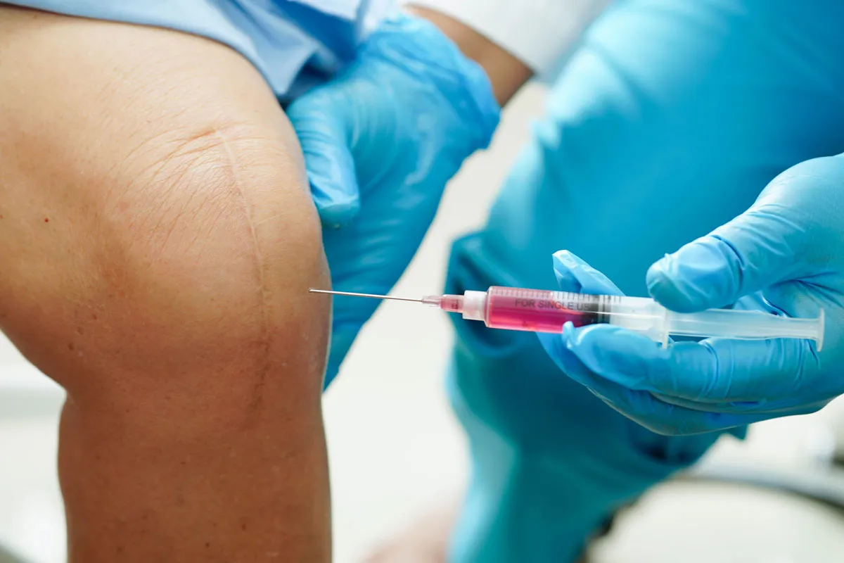 Overview and Definition img 3 8 LIV Hospital