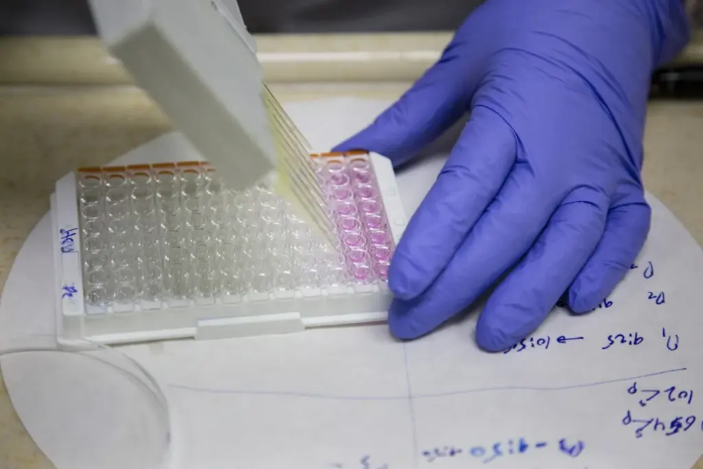 Differential Diagnosis and Exclusion