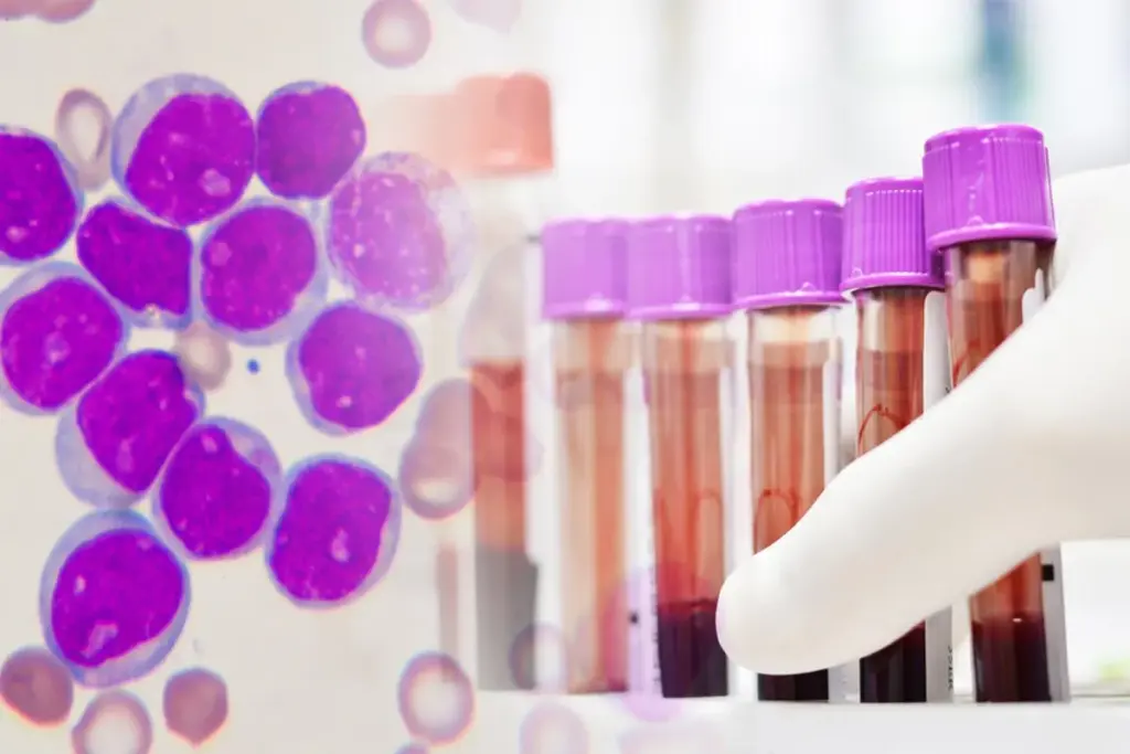 Hematological Analysis