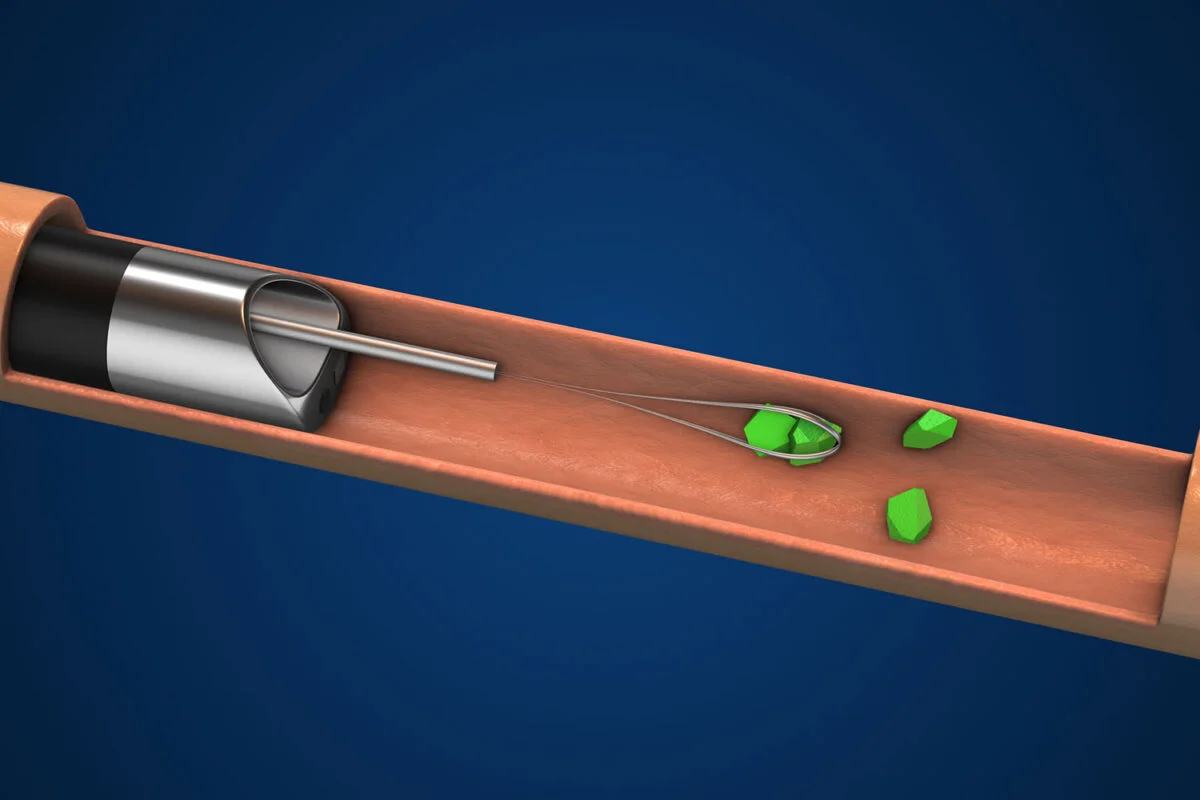 The Physics of Shock Wave Generation