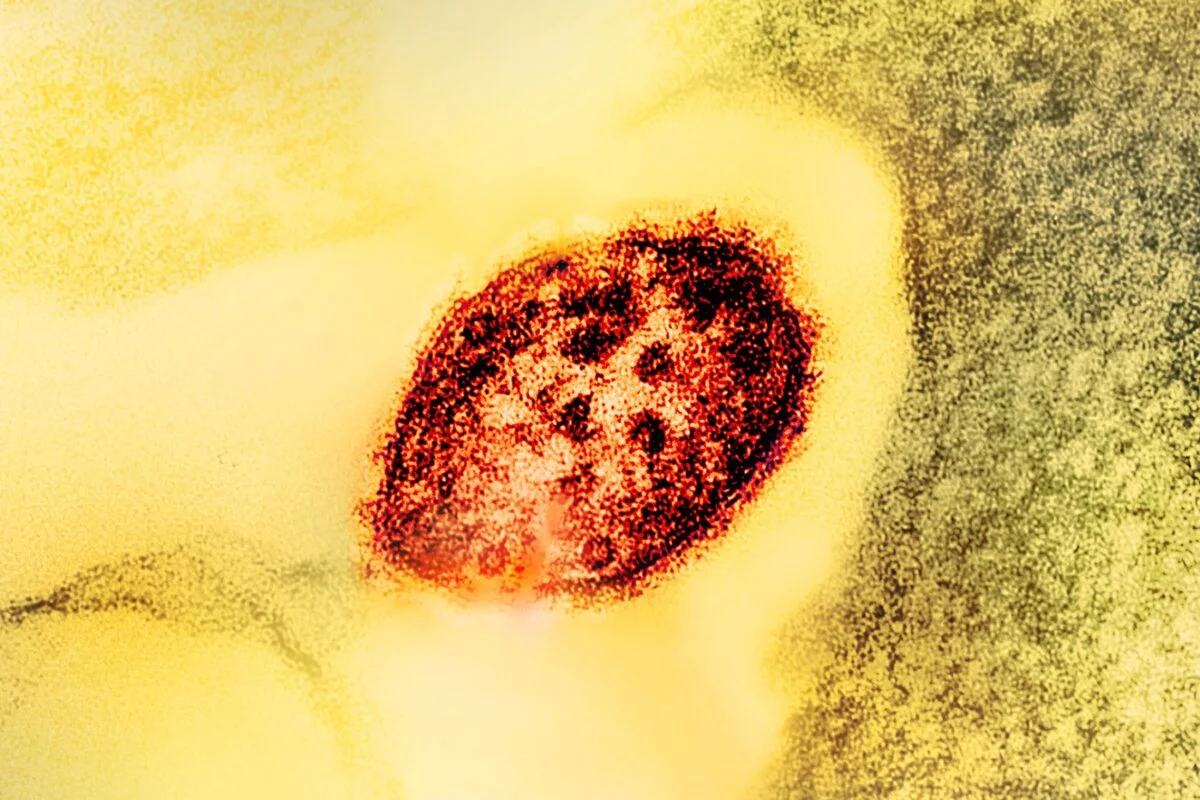 Ribavirin and Antiviral Considerations