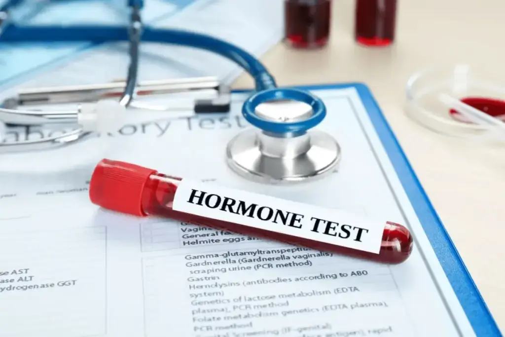 Endocrine evaluation is vital for patients with proximal hypospadias or those suspected of having a DSD. The “mini puberty” of infancy (between 1 and 4 months of life) offers a window to assess the endogenous hormonal axis. Serum levels of Testosterone, Luteinizing Hormone (LH), and Follicle Stimulating Hormone (FSH) are measured. If the window of mini puberty is missed or if basal levels are low, a Human Chorionic Gonadotropin (hCG) stimulation test is performed. This test measures the Leydig cell reserve by quantifying the rise in testosterone following hCG administration. A failure to respond suggests testicular dysgenesis or a defect in testosterone biosynthesis. Additionally, measuring precursors like 17-hydroxyprogesterone is mandatory to rule out Congenital Adrenal Hyperplasia, a life-threatening condition involving salt wasting.
