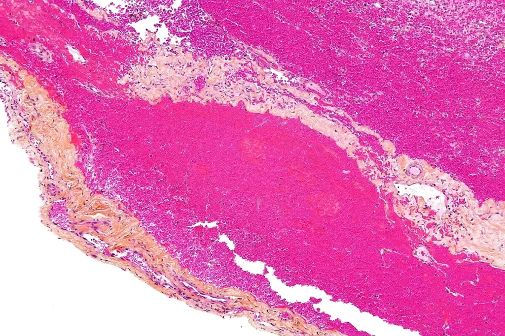 Microbiology: The Usual Suspects