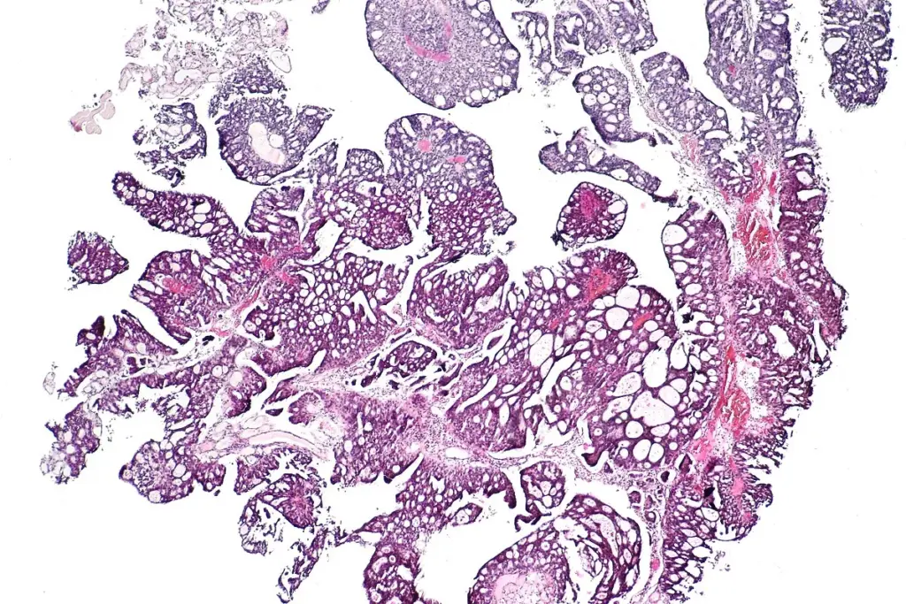 image 20 15 LIV Hospital