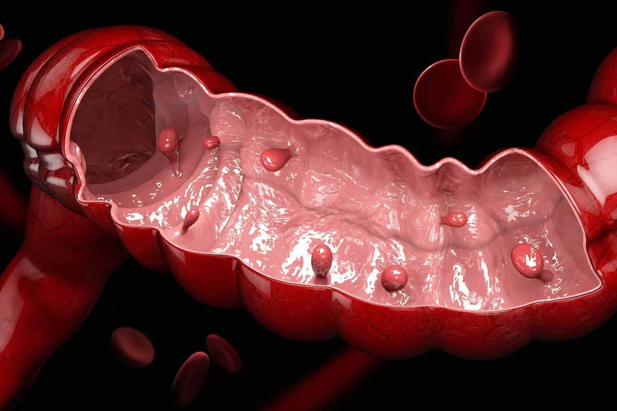Retrograde Urethrogram (RUG)