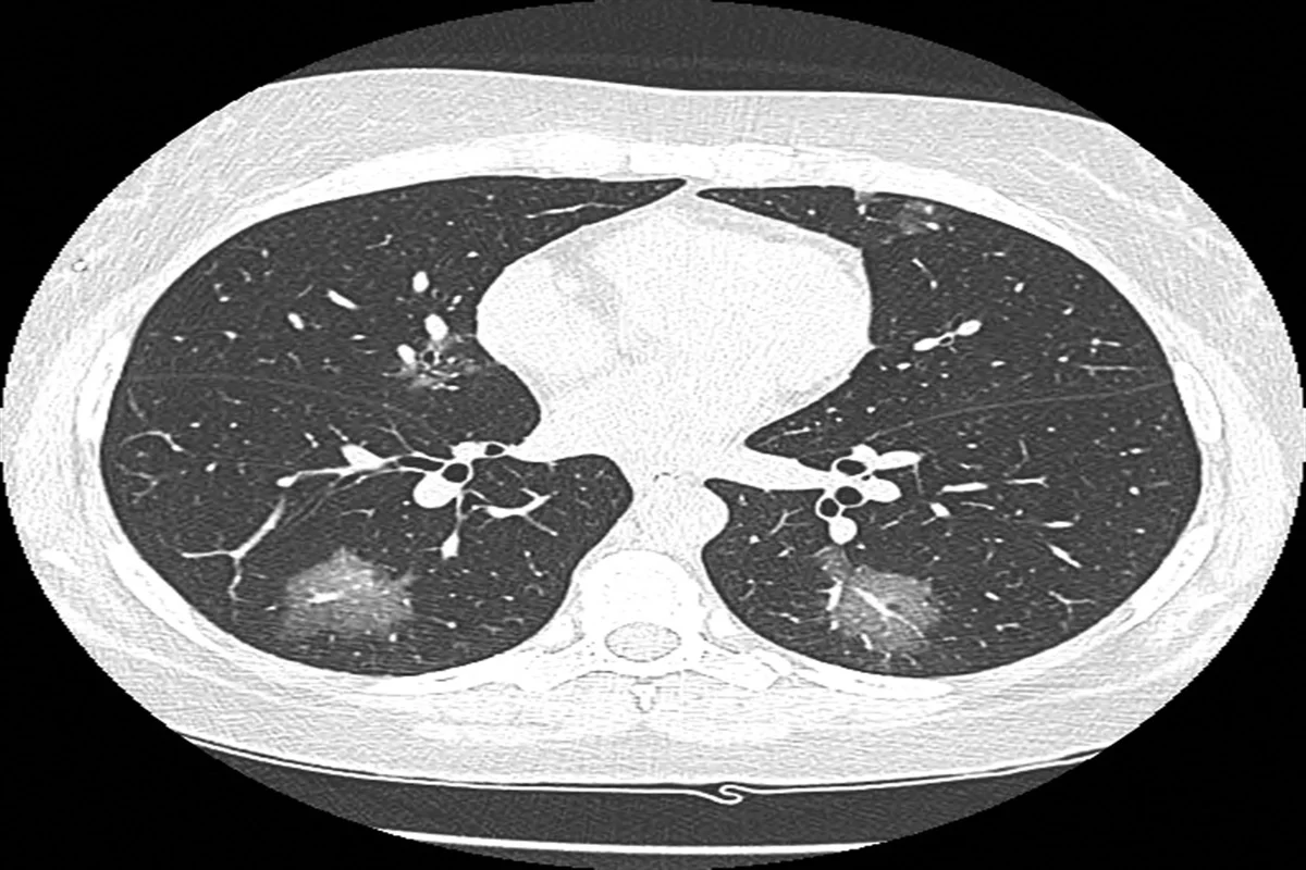 image 22 15 LIV Hospital