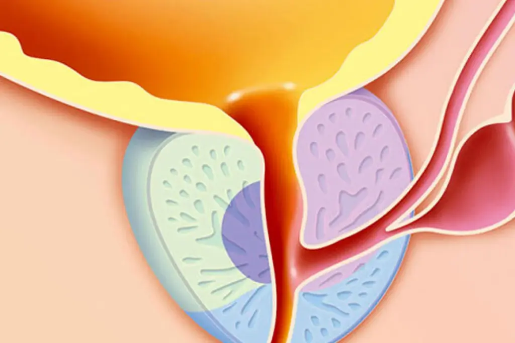 Systemic Risk Factors and Metabolic Comorbidities