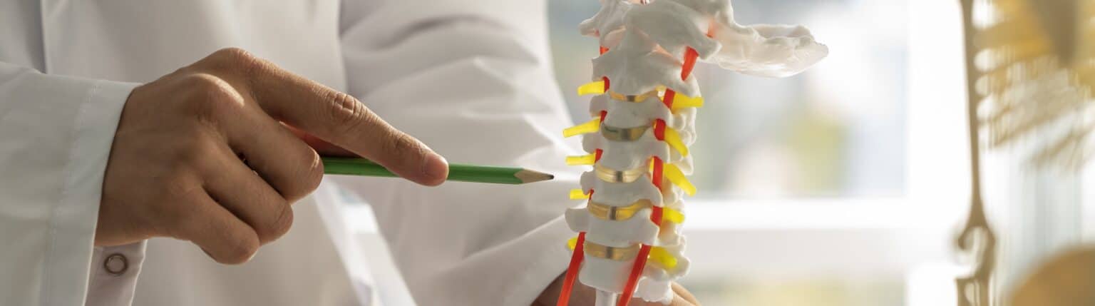 ankylosing spondylitis