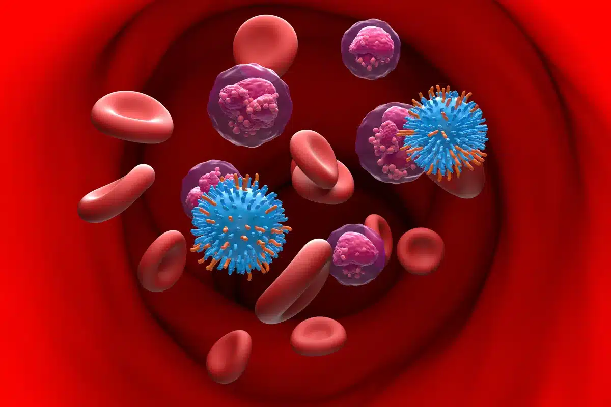 Lymphocytic Leukemia: Symptoms and Causes