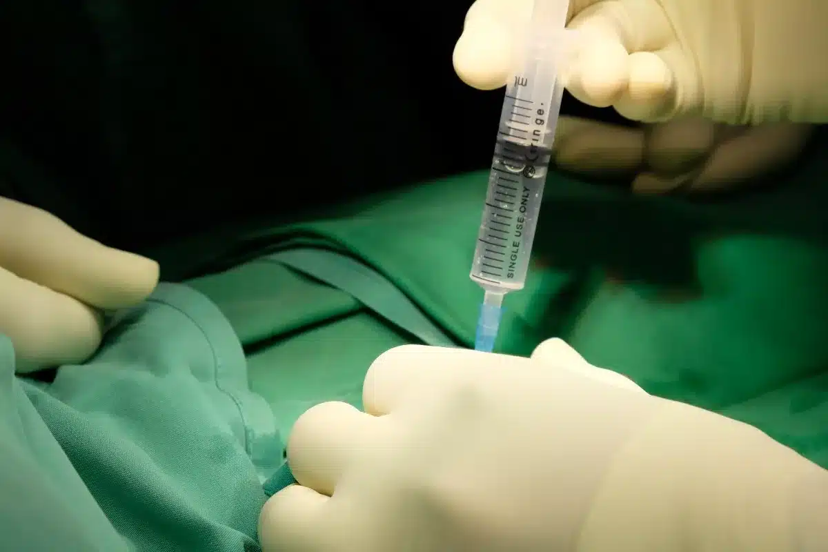 Biopsy and Histology