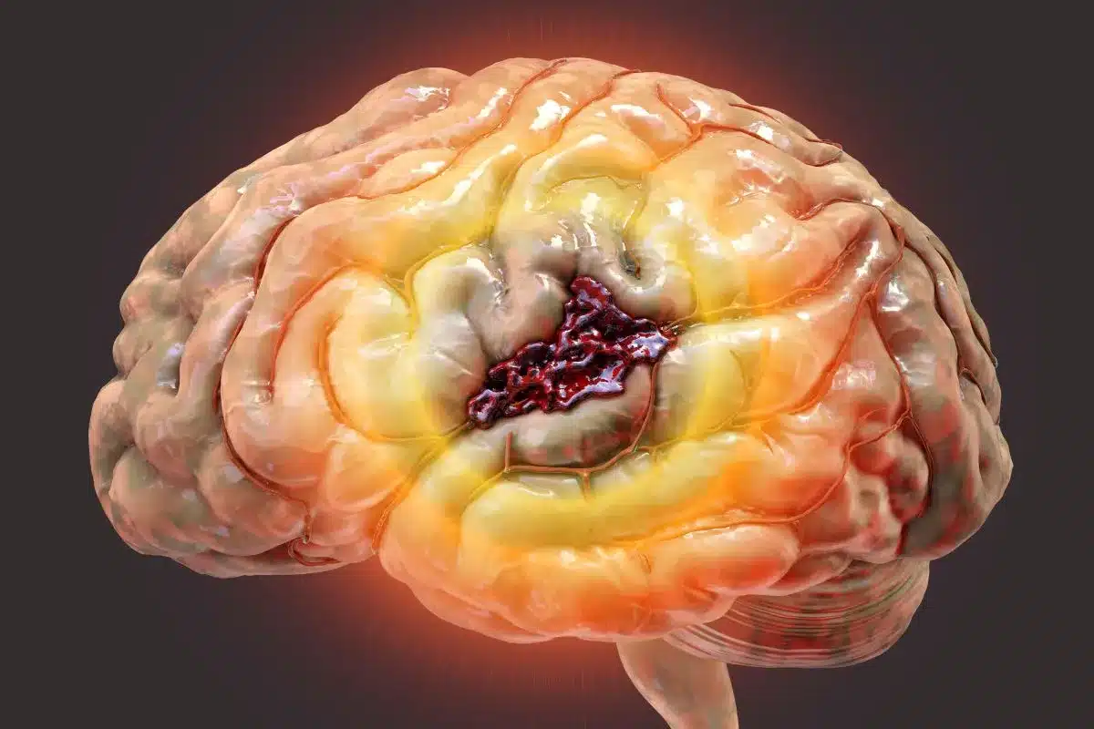 Hemorrhagic Dynamics