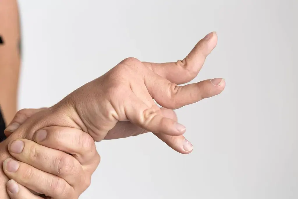 Post-Stroke Epilepsy and Spasticity