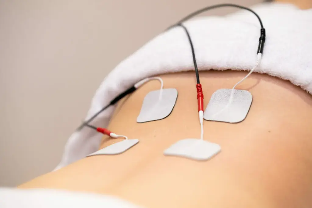 Nerve Stimulation Therapies