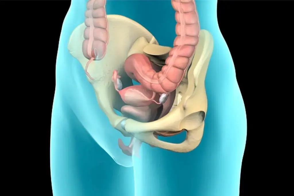 Surgical Repair for Prolapse