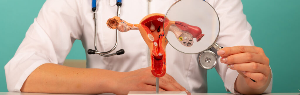 male doctor showing anatomical model female reproductive organs using magnifying glass early diagnosis treatment 2 LIV Hospital