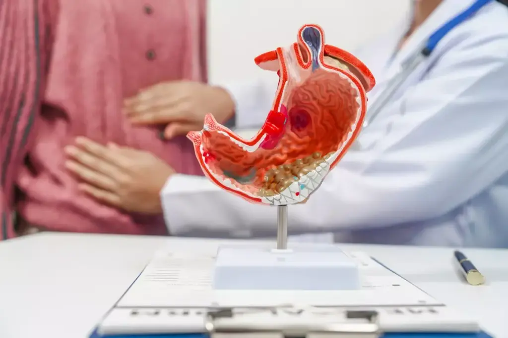 The Role Of The Lower Esophageal Sphincter
