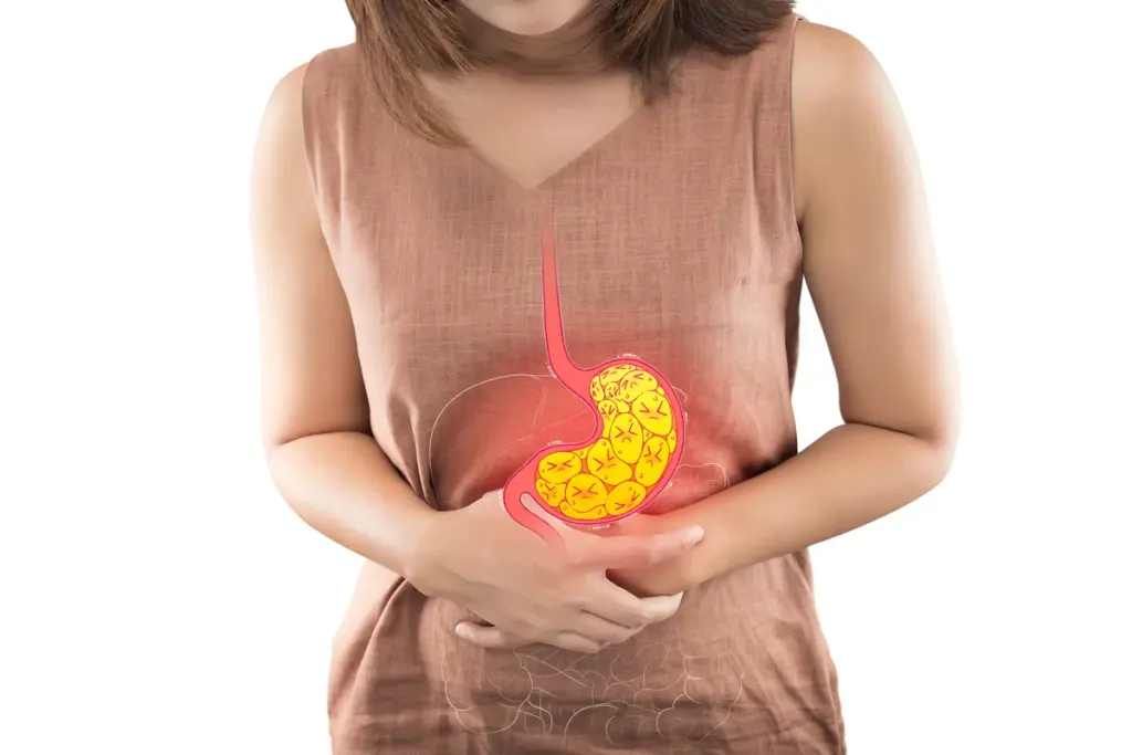 Reflux Disease: Diagnosis And Evaluation