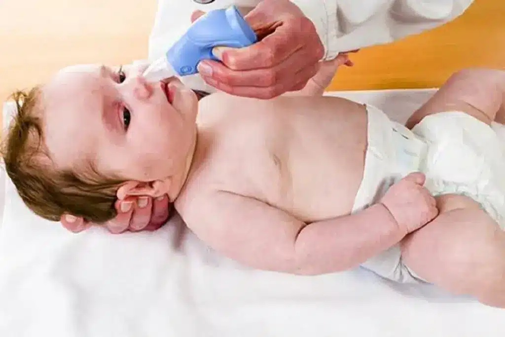 Breathing and Feeding Difficulties in Infants