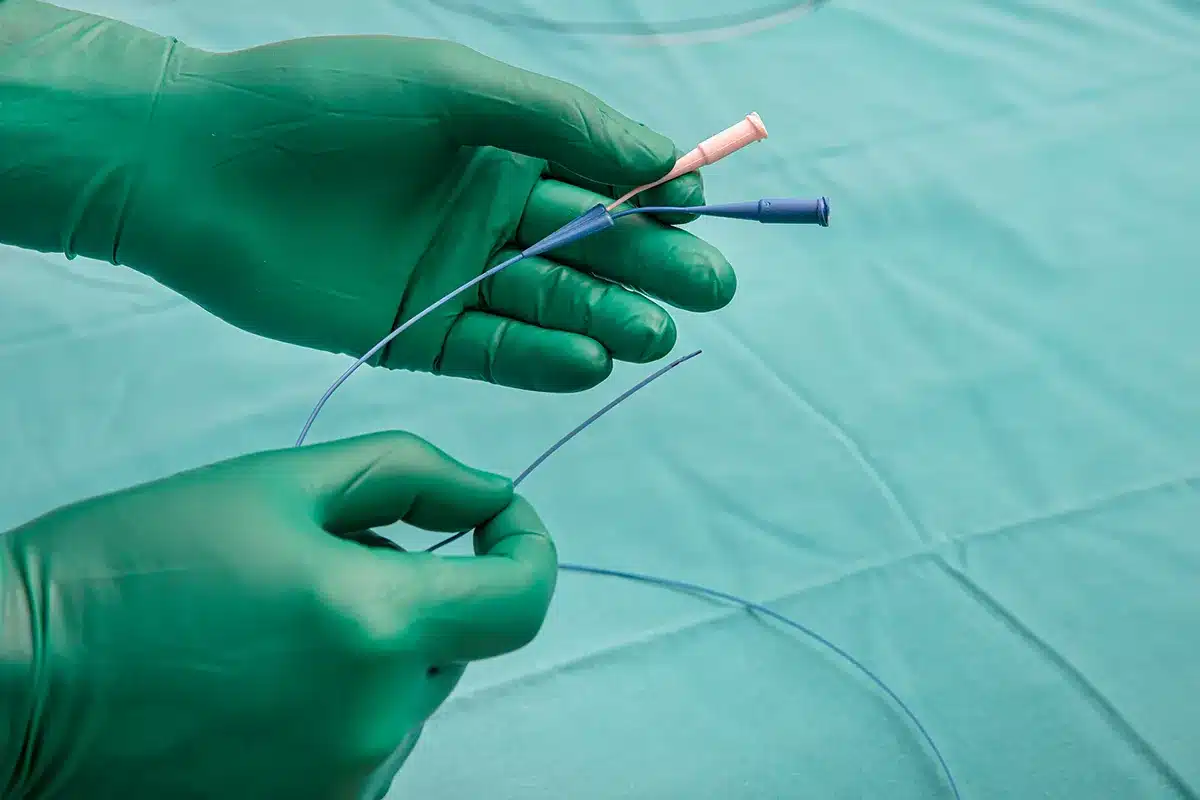 Transcranial Doppler (TCD)