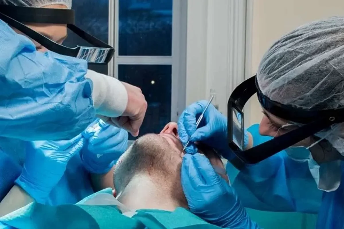 Non-Surgical Hair Restoration