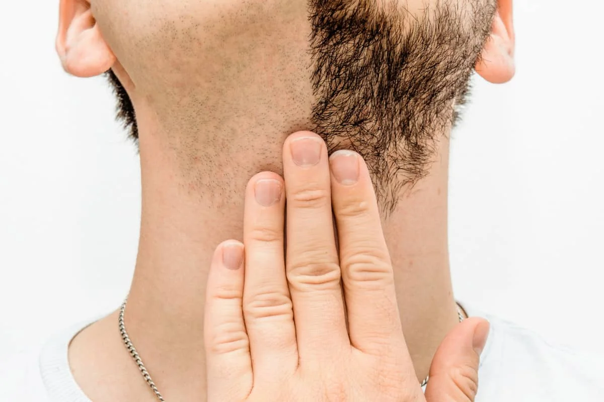 Non-Surgical Hair Restoration