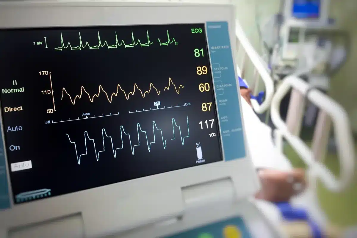 Medications: Anti-arrhythmics and Rate Control