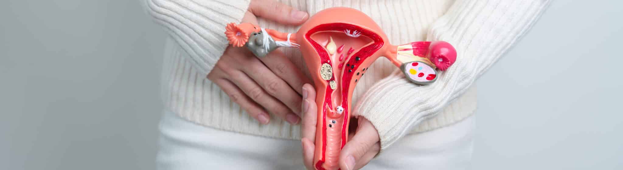 Woman holding Uterus and Ovaries model. Ovarian and Cervical cancer, Cervix disorder, Endometriosis, Hysterectomy, Uterine fibroids, Reproductive system and Pregnancy concept
