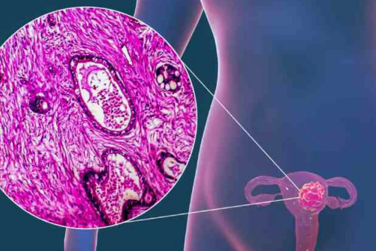 The Cellular Biology of Cervical Neoplasia