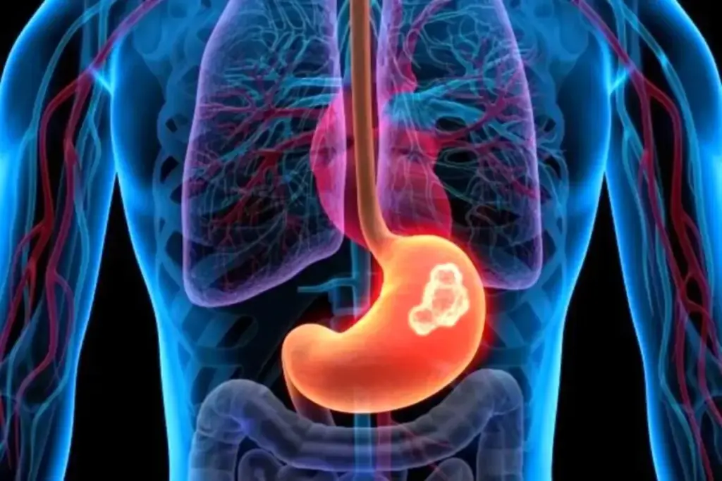 The Multidisciplinary Tumor Board