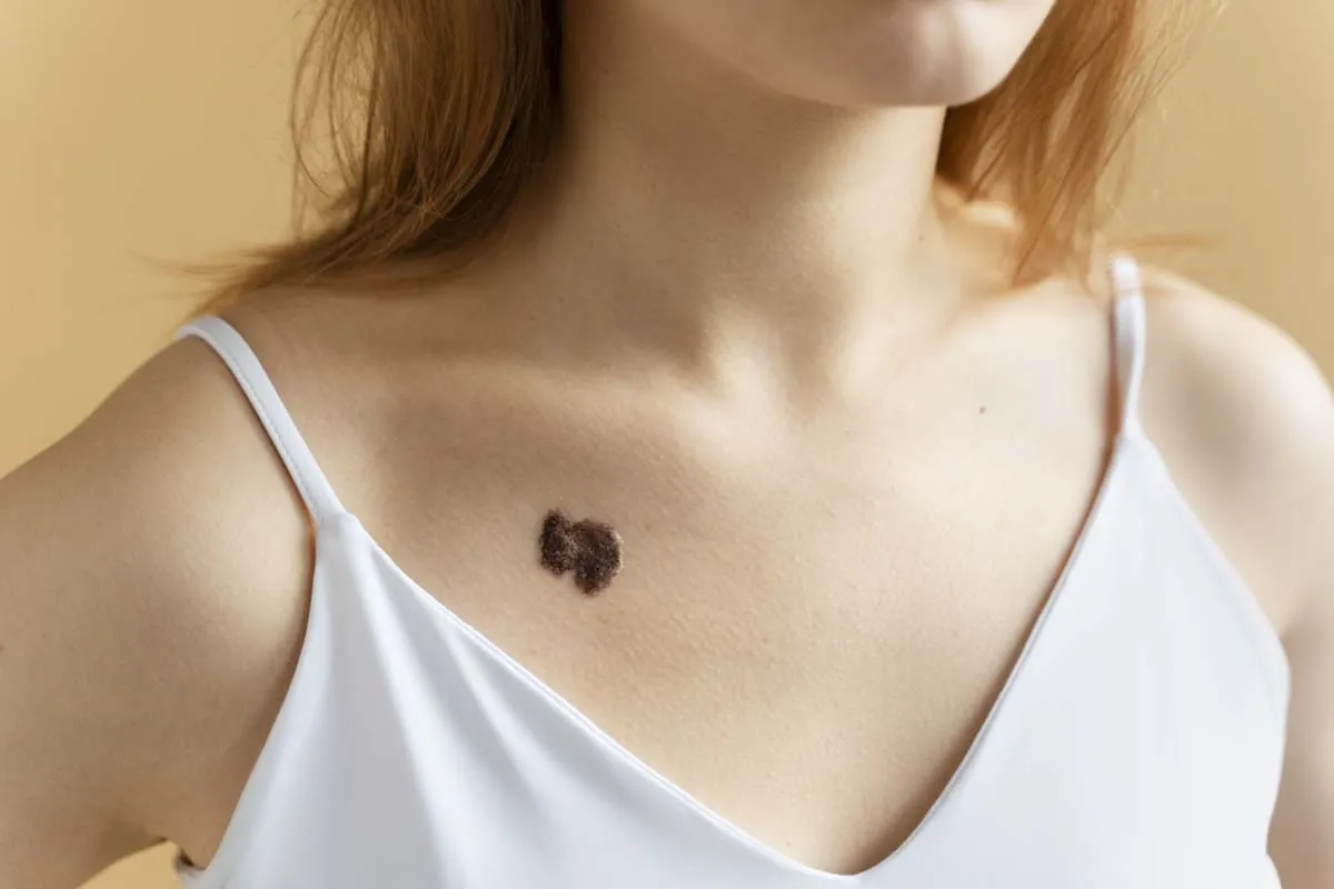 The Biological Mechanism of Malignancy