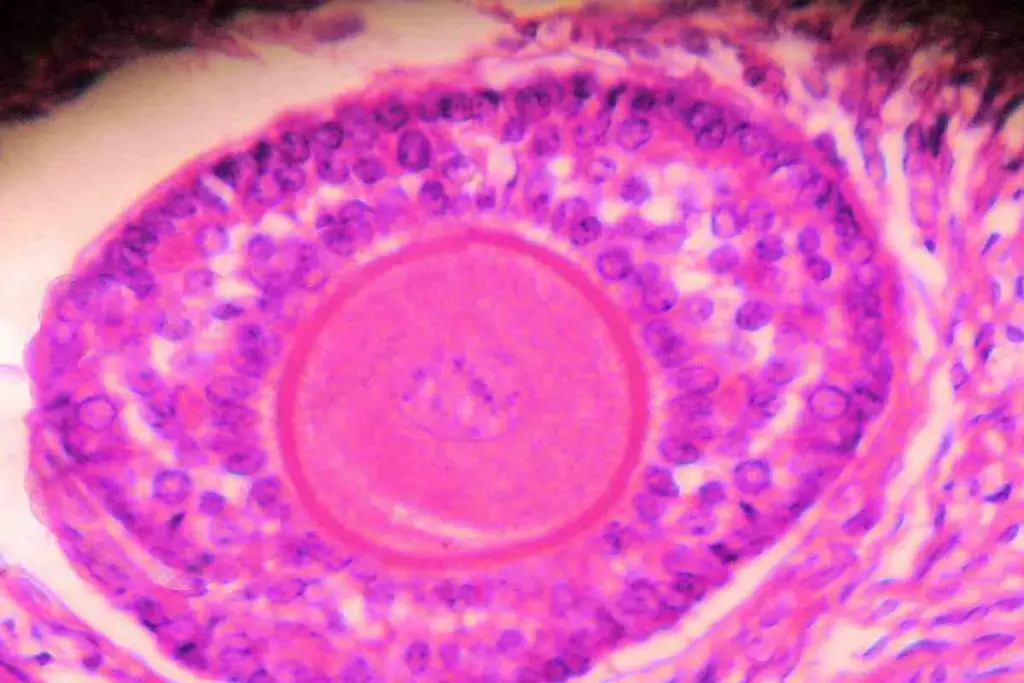 Non-Epithelial Ovarian Malignancies