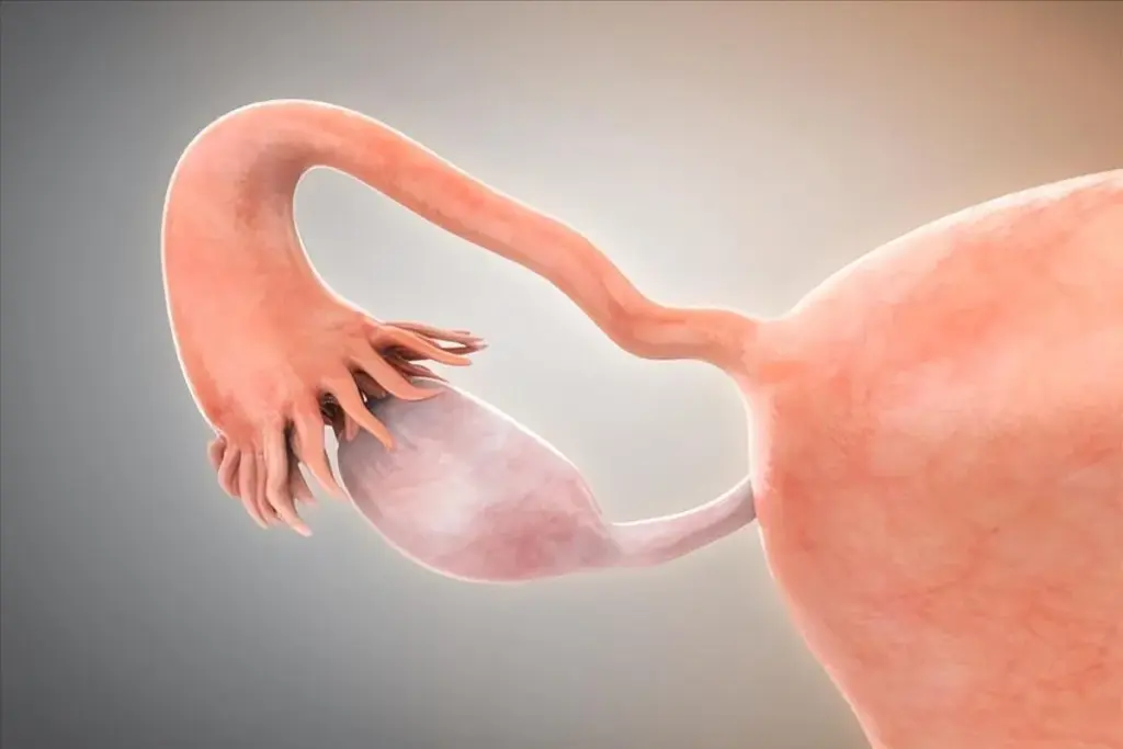 Ovulatory Factors and Reproductive History