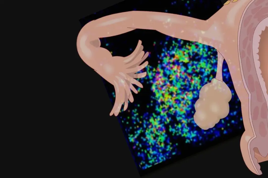 Endometriosis and Inflammatory Drivers