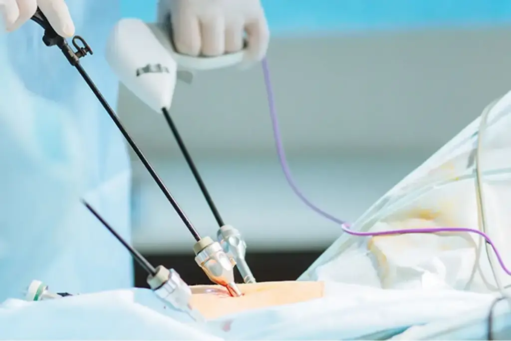 Cross-Sectional Imaging and Staging Laparoscopy