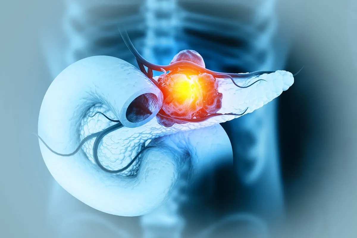 Managing Diabetes and Endocrine Dysfunction