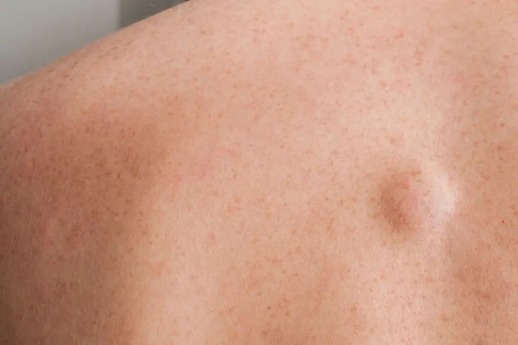 Molecular Mechanisms of Nociception and Inflammation