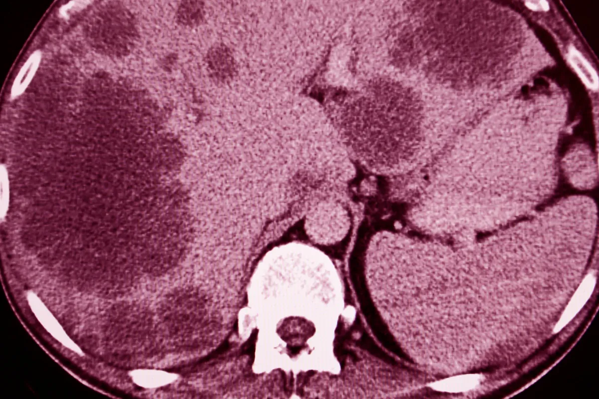 image 18 52 LIV Hospital