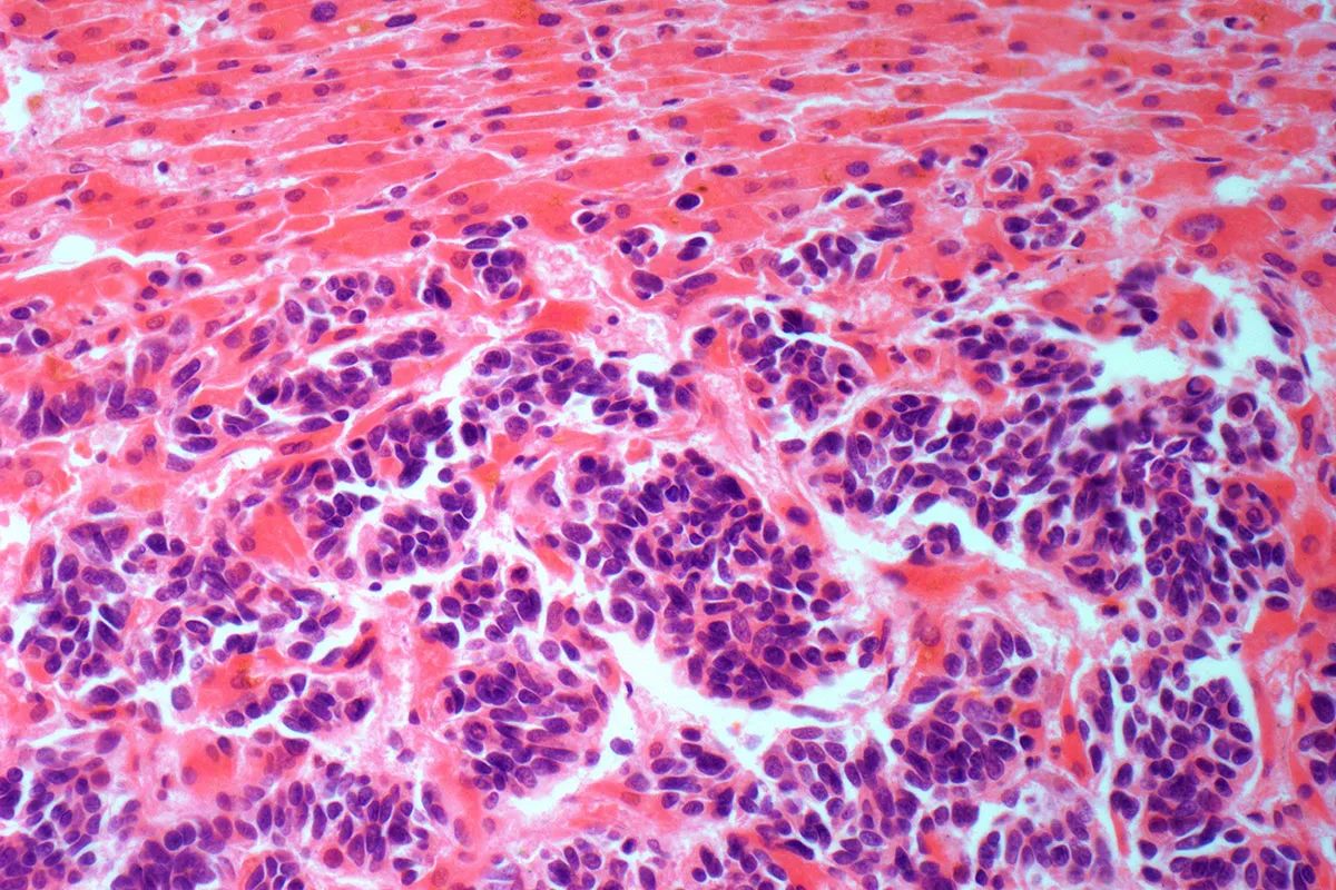 Advanced Imaging Characteristics