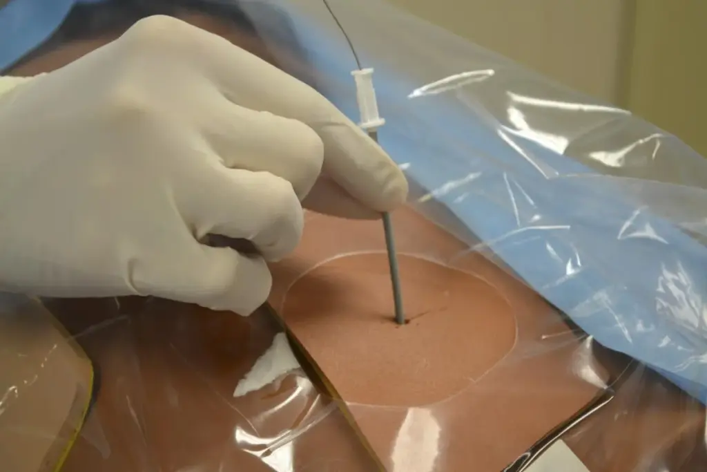 Percutaneous Ablation Techniques