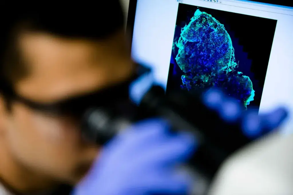 Diagnosis and Staging