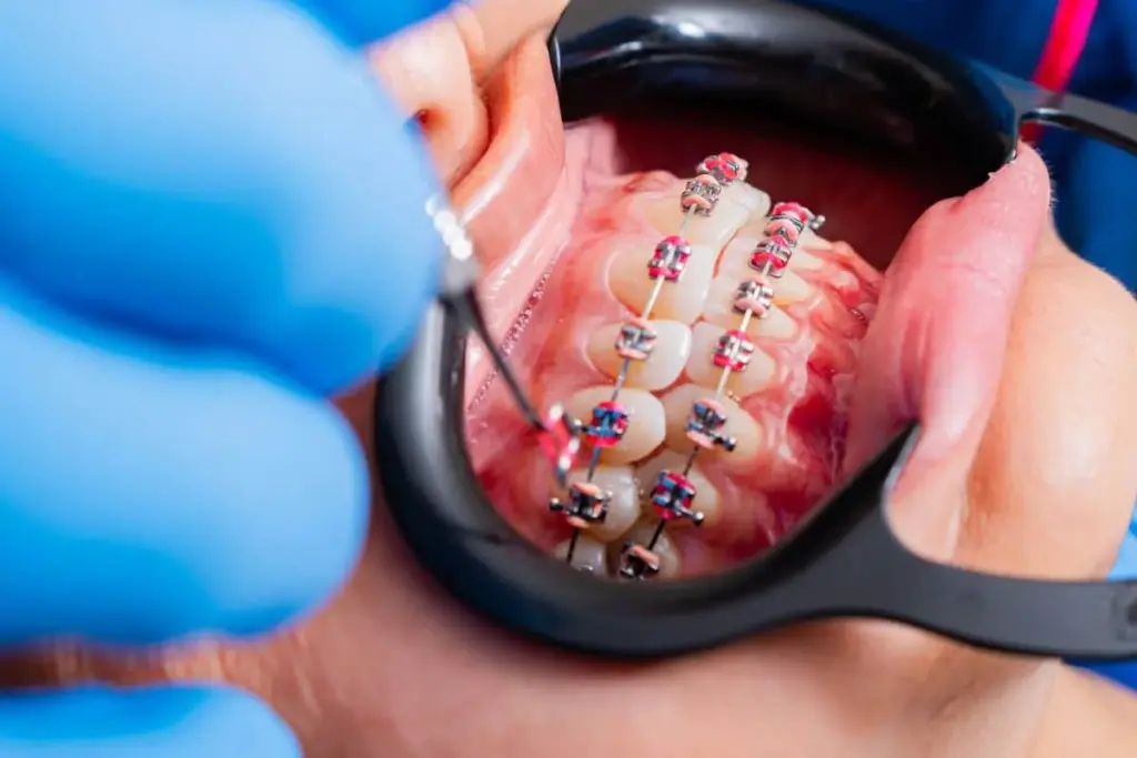 image 6 1 12 LIV Hospital