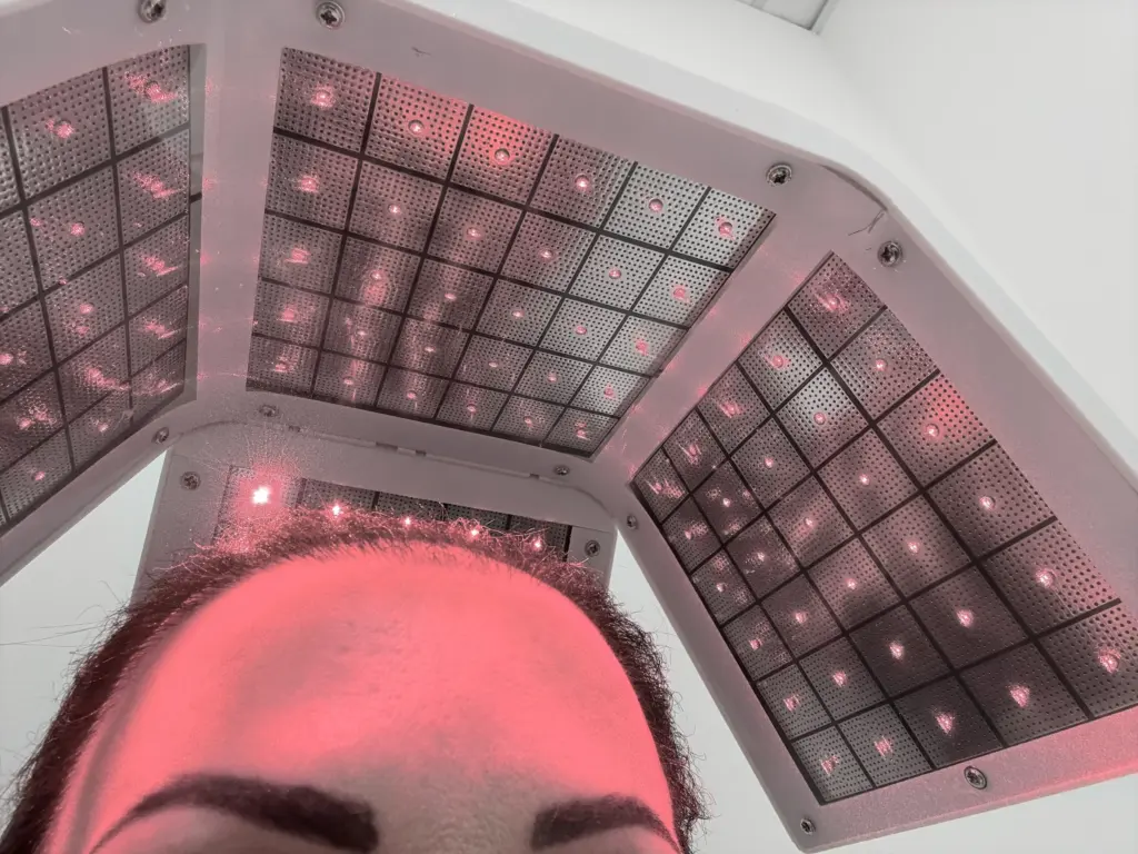 laser-hair-therapy-recovery-process