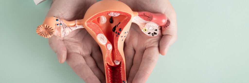 doctor gynecologist holds model female reproductive system hands help care concept 1 LIV Hospital