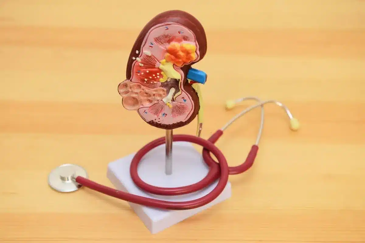 Overview and Definition