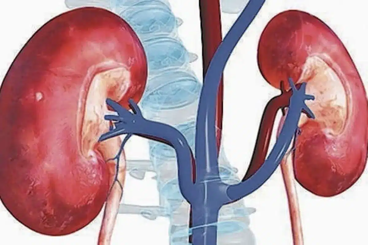 Risk Factors for Renal Artery Stenosis