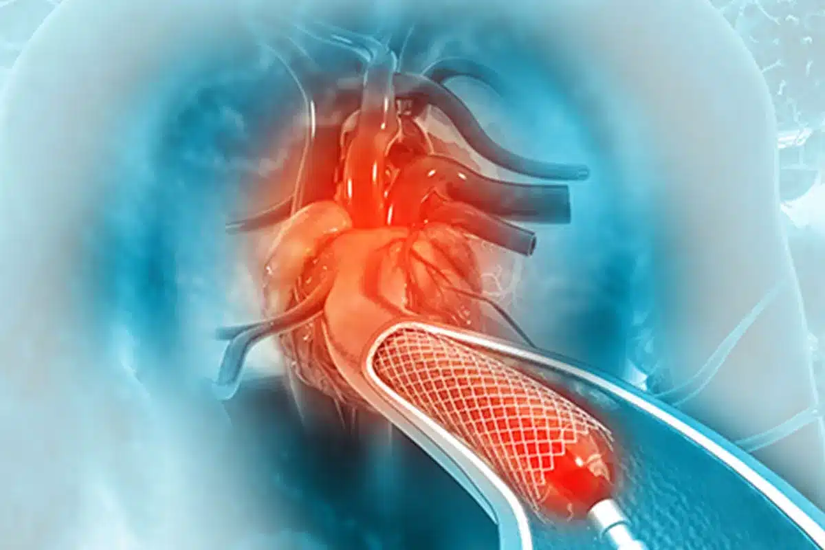 Symptoms and Risk Factors